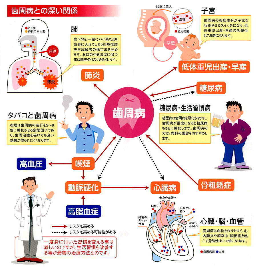 ♡裁断済 歯周病と全身疾患 2版 歯周病と全身疾患 最新エビデンスに基づくコンセンサス Second